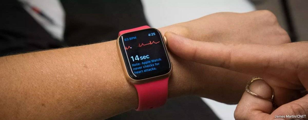 Attivo negli USA l’elettrocardiogramma nell’Apple Watch 4 e una giornalista scopre subito di avere un problema cardiaco