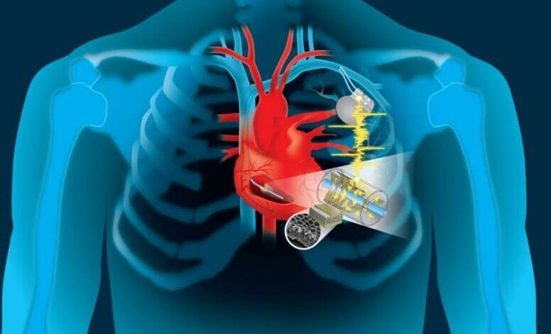 pacemaker startup-news