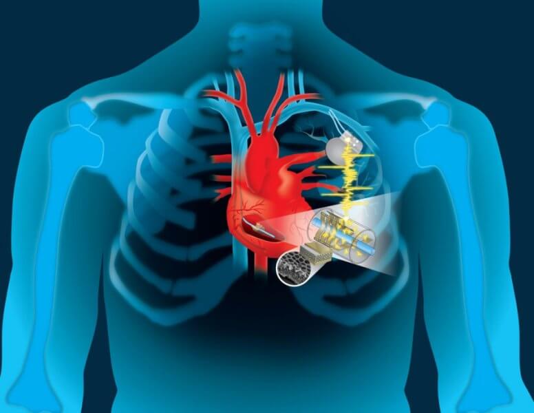 I battiti cardiaci potranno ricaricare i pacemaker che non dovranno più essere sostituiti I battiti cardiaci potranno ricaricare i pacemaker che non dovranno più essere sostituiti