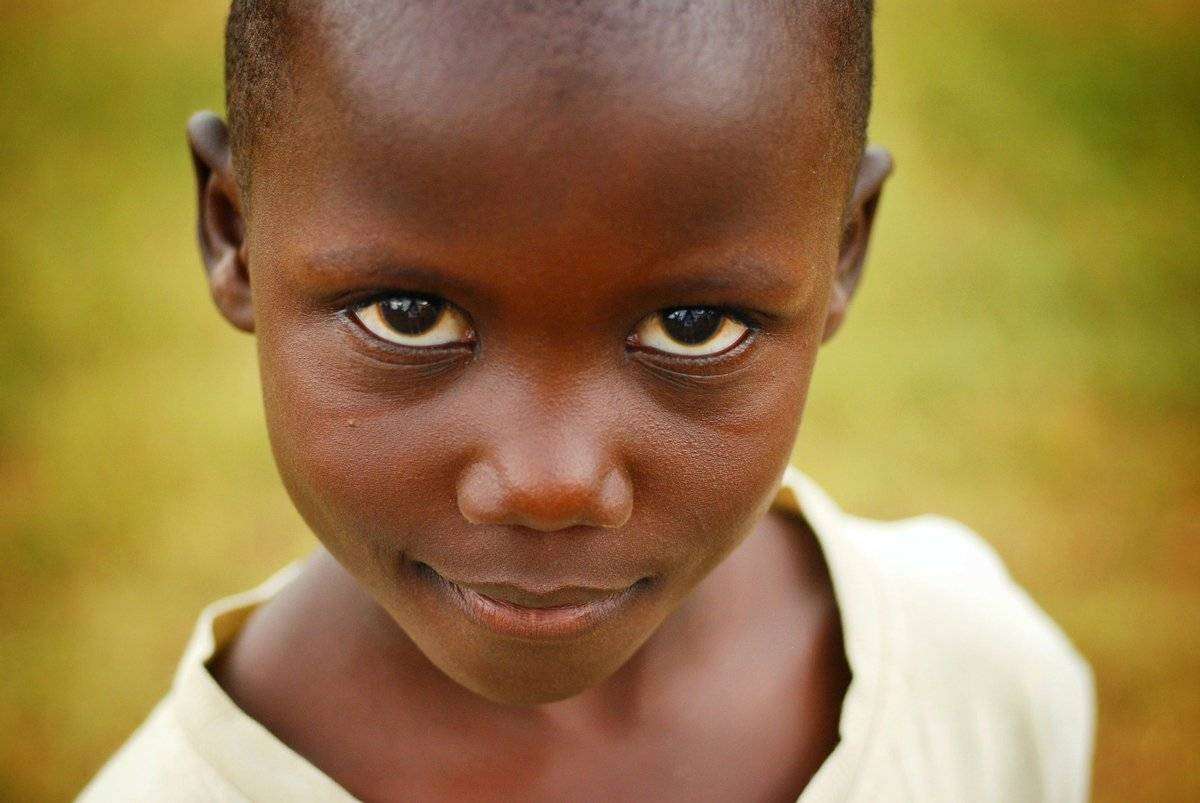 The Life Box: la startup Corax porta in Africa il suo prototipo per salvare i bambini ustionati The Life Box: la startup Corax porta in Africa il suo prototipo per salvare i bambini ustionati